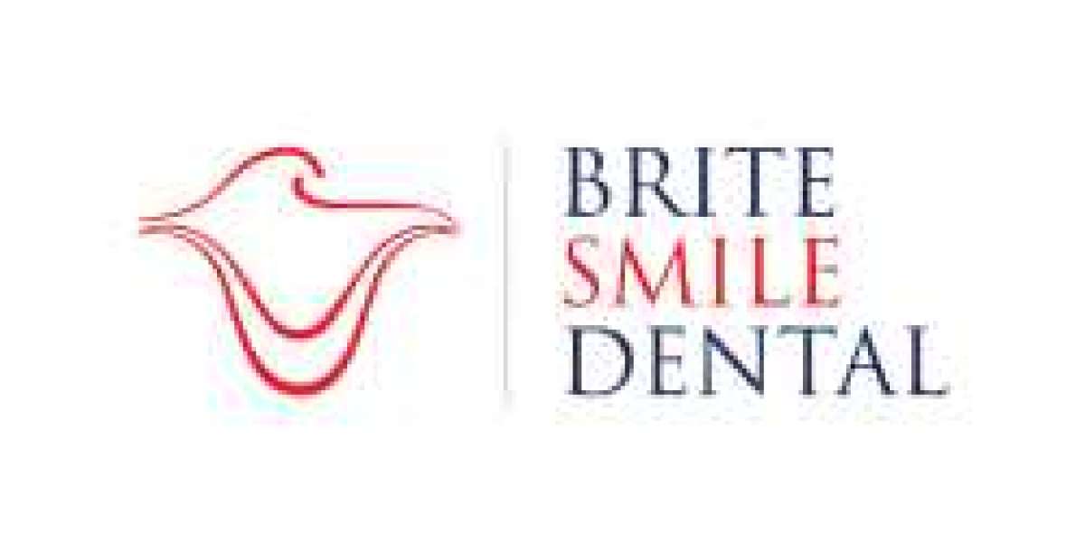 San Diego veneers - Brite Smile Dental